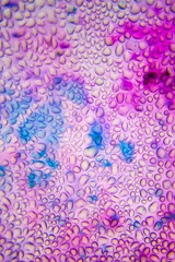 Images of biological tissues in a microscope. Real photo, blur zones possible
