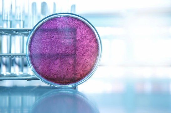 purple pretri dish in microbiology science laboratory and test tube background