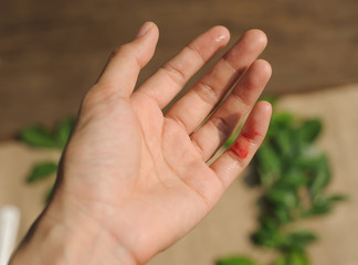 Fototapeta na wymiar bleeding from accident cut the finger