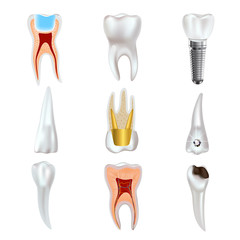 Dental implant and real tooth anatomy icon set.