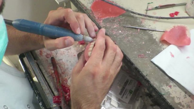 In un laboratorio dentale costruzione impianto dentale