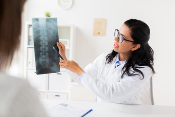 doctor with x-ray of spine and patient at hospital