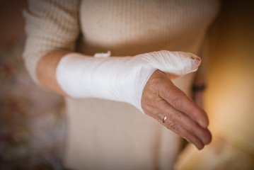 Woman with hand in gypsum. Selective focus.
