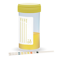 Urine Test Strip With The Plastic Jar Of Urine. Medical Examination Isolated On A White Background. Realistic Vector Illustration.