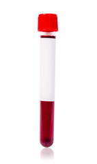 Red vacuum blood tube test with sample blood.