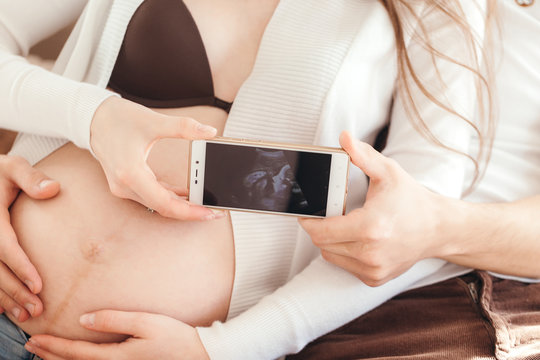 Young couple in love showing an ultrasound picture of their baby