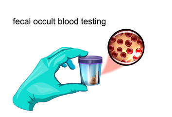 fecal occult blood testing - obrazy, fototapety, plakaty