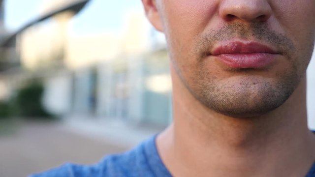 man touching sores on the lips. herpes. lip treatment