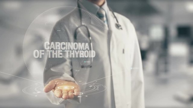 Doctor holding in hand Carcinoma of the Thyroid