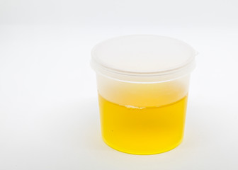Healthcare And Medicine. Medical urine test, close-up,Urine sample.
