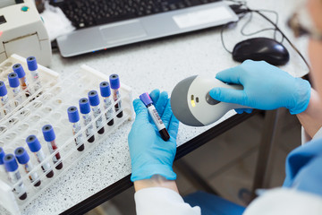 Technician hands scanning bar codes on biological sample tube in the lab of blood bank.