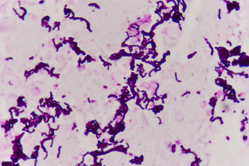 Gram staining, also called Gram's method, is a method of differentiating bacterial species .