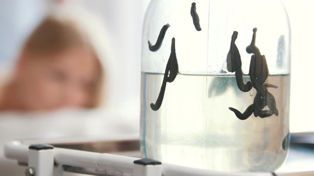 Hirudotherapy - leeches in clinic, in front of massage woman