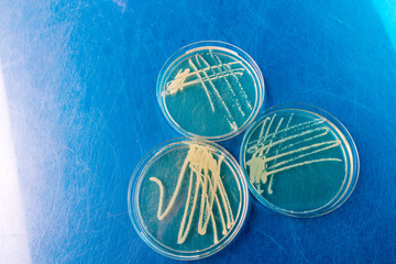 Petri dishes with biological samples  for medical and biological analyzes