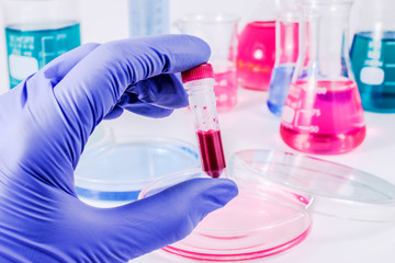 Scientist with blood sample. Medical laboratory.