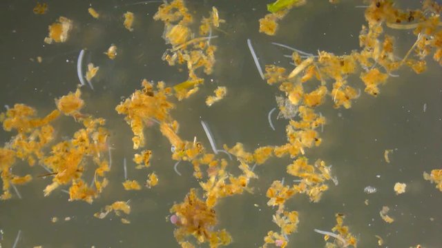 Tiny white worms from a pond, under stereo microscope
