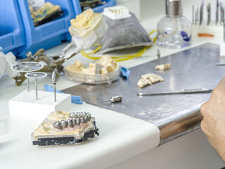 Dental technician making a metal structure of a dental crown or bridge.