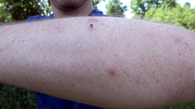 meine M&uuml;cke sitzt auf einem Arm und saugt Blut