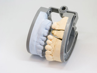 Gray dental prosthesis teeth mold clay human gums