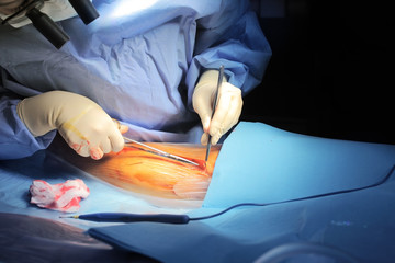 Surgeon cuts the patient's skin during procedure - obrazy, fototapety, plakaty
