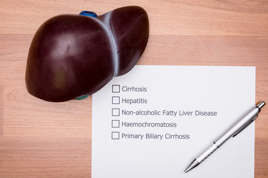 In the doctor's Office There is a form that the doctor made to diagnose the disease that occur in a patient's liver. Diagnosis form placed on the doctor's desk.