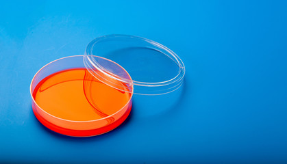 Petri dishes with blood agar