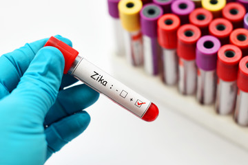 Obraz premium Blood sample positive with Zika virus 