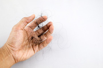 hair loss problem on hand