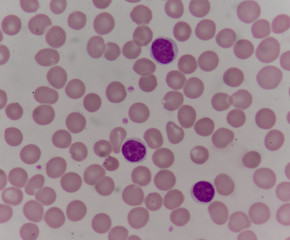 blood cells with microscope.