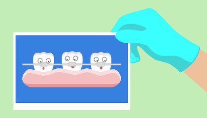 tooth cartoon vector, orthodontics teeth or dental braces
