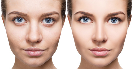 Portrait of woman before and after retouch.