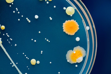 Petri dishes with colonies of microbes