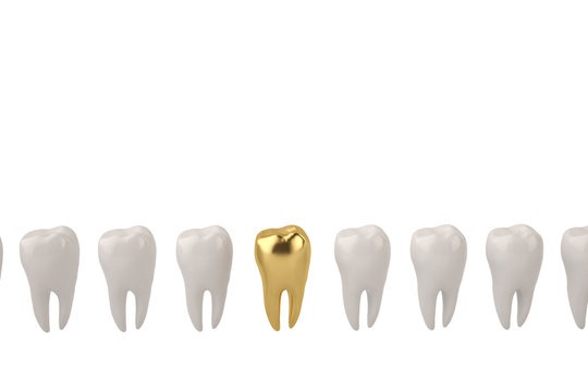 Gold tooth and clean tooth on white background 3D illustration.