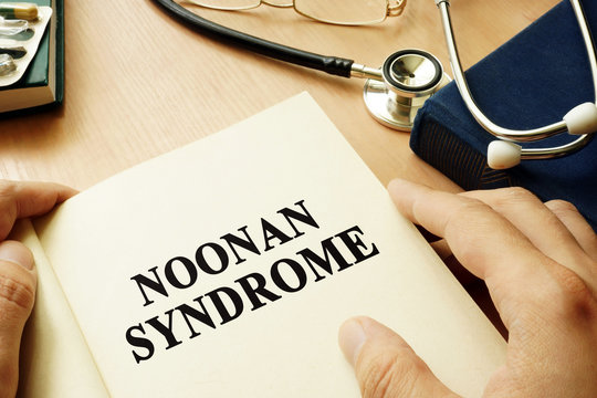 Book With Title Noonan Syndrome On A Table.