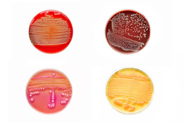 Bacteria colonies in various petri dish
