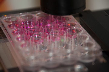 Pipetting of microtiterplates in laboratory, close-up