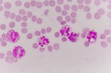 Neutrophil cell in blood smear
