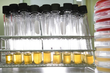 experiment in chemical laboratory with yellow liquid for analysis