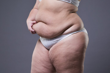 Woman with fat abdomen, overweight female stomach