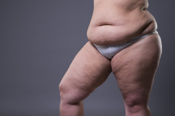 Fototapeta na wymiar Woman with fat abdomen, overweight female stomach