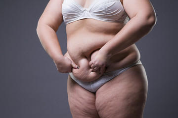 Woman with fat abdomen, overweight female stomach