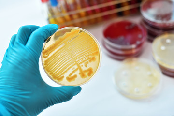 Yellow colonies of bacteria in petri dish 