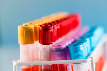 Test tubes with blood for medical and biological analyzes