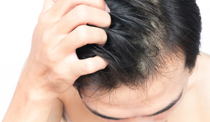 Closeup man hand itchy scalp, Hair care concept