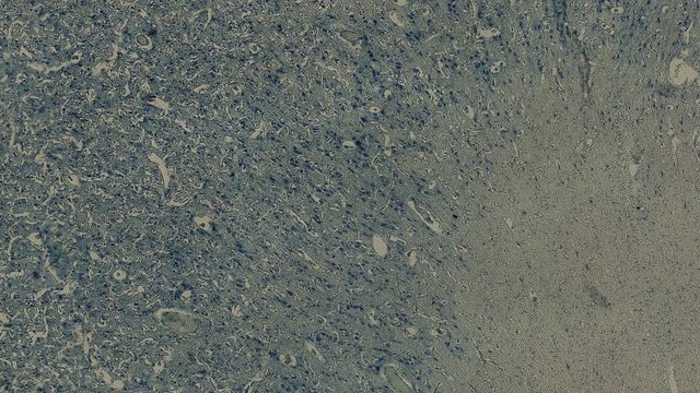 human nissl cells under a microscope zoom in animation