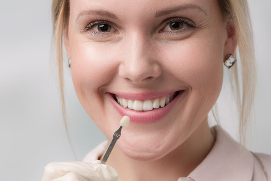 Zahnfarbvergleich am Mund einer hübschen Patienten