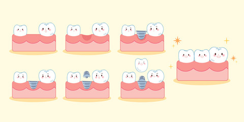 cartoon tooth implant smile happily