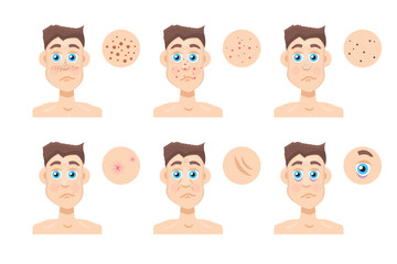 Men skin problem. Acne men. Vector illustration.