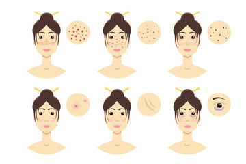 Woman with skin problem, acne. Vector illustration