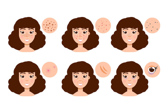Woman with skin problem, acne. Vector illustration